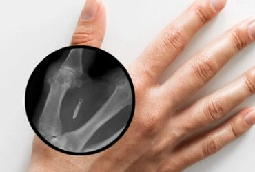Washington May Soon Ban Mandatory Employee Microchips 7 Washington May Soon Ban Mandatory Employee Microchips