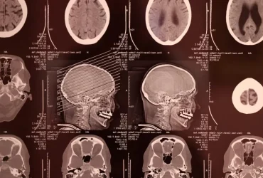 Meta’s Brain2Qwerty v2: AI Translates Brain Scans into Text 5 Meta’s Brain2Qwerty v2: AI Translates Brain Scans into Text